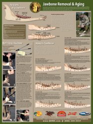 Thumbnail of Jawbone Removal and Aging Poster