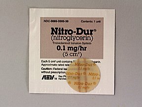 Nitro-Dur 0.6 mg/Hr Patches 30 By Merck & Co.