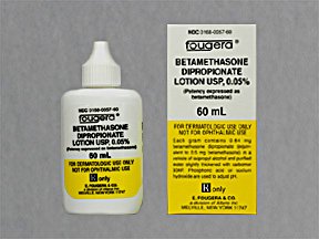 side effects of betamethasone dipropionate lotion