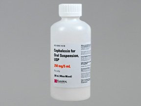 Cephalexin 250mg/5ml Suspension 200 Ml By Karalex Pharma.