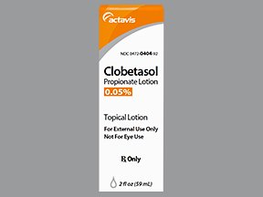 Clobetasol Propionate 0.05% Lotion 2 Oz By Actavis Pharma