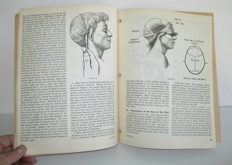 U.S. Military Autopsy Manual, July 1960