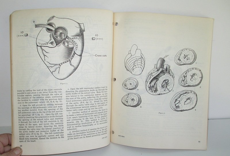 U.S. Military Autopsy Manual, July 1960