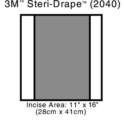 3M Steri-Drape 2 ise Drapes Case 2040 By 3M Health Care