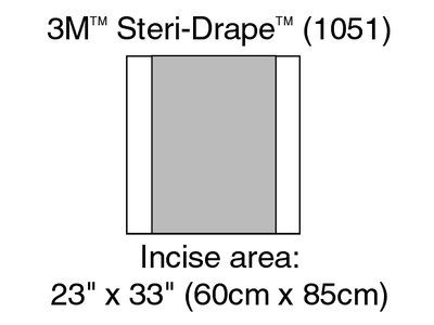 3M Steri-Drape ise Drapes Case 1051 By 3M Health Care