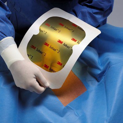 3m Ioban 2 Antimicrobial Ise Drape Case 6661ez By 3m Health Care