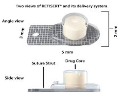 Rx Item-Retisert 0.59Mg Implant By Valeant Pharma