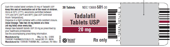 Rx Item-Tadalafil 20MG 30 Tab by Torrent Pharma USA Gen Adcirca EXP 5/23