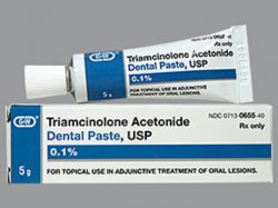 Rx Item-Triamcinolone 0.1% 5 GM Paste by Cosette Pharma USA Gen Kenalog