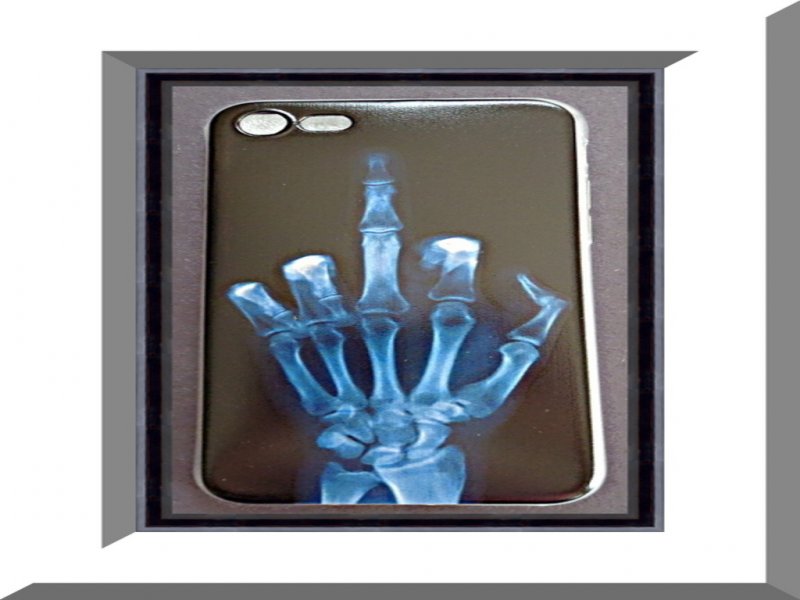 Image 0 of Black & White Silicone Iphone 8 Case Middle Finger X-Ray Skeleton Design
